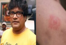 Bollywood: ಶೂಟಿಂಗ್ ವೇಳೆ ಕಚ್ಚಿದ ವಿಷಪೂರಿತ ಜೇಡ: ನಟ ರಾಜೇಶ್ ಶರ್ಮಾ ಸ್ಥಿತಿ ಗಂಭೀರ..