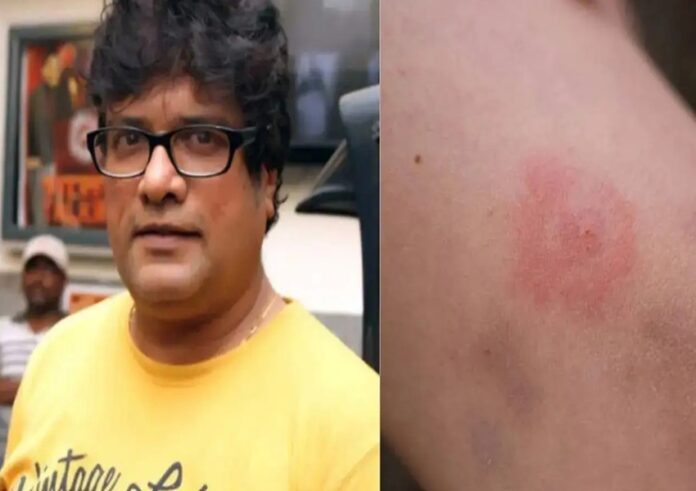 rajesh
